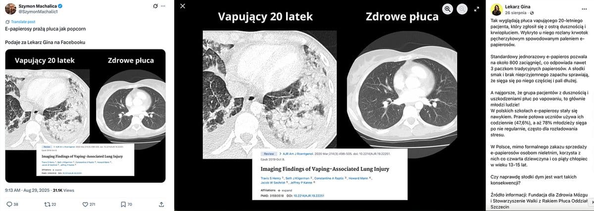 papierosy tradycyjne, e-papierosy, porównanie szkodliwości, dawka diacetylu papieros, dym papierosowy - Tradycyjne papierosy kontra e-papierosy – czy można mówić o ...